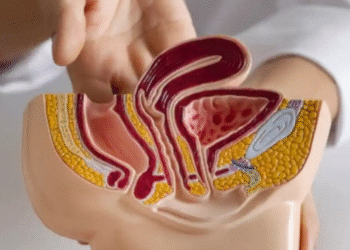 Vasektomi Tidak Ganggu Fungsi Seksual, Dokter Tegaskan Mitos Harus Diluruskan