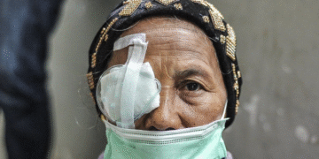 BPJS Kesehatan Tegaskan Layanan Katarak Tetap Dijamin, Akses di Daerah Terpencil Diperkuat