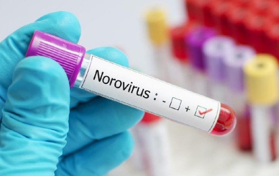 Wabah Norovirus di Kapal Pesiar Ambition, Prancis Isolasi Ribuan Penumpang di Bordeaux
